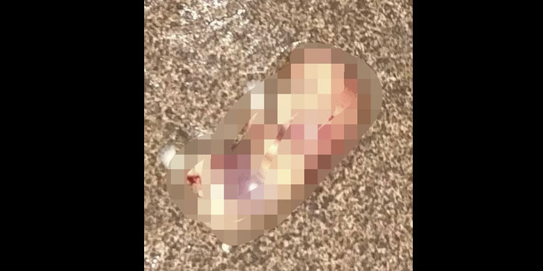 Warga Desa Kekiling Dihebohkan Dengan Penemuan Sosok  Janin Di SPBU Desa Setempat