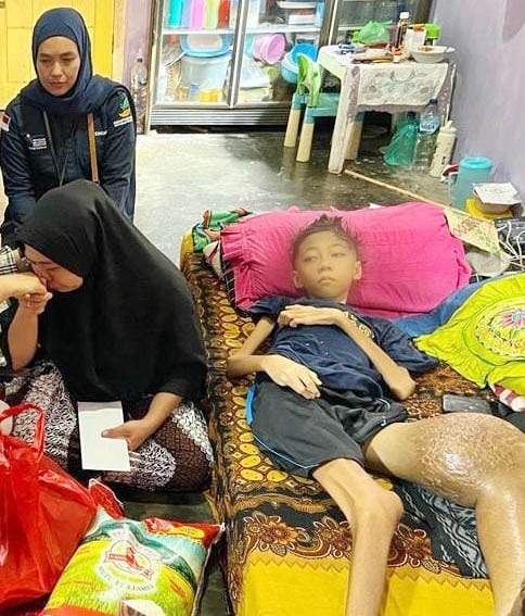Kadis Sosial Lamsel: Kementerian Sosial Besok Bakal Turun Bantu Farel Penderita Kanker Tulang